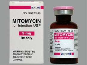 40 - Nach jeder TUR - B  muss eine Mitomycin-Instillation durchgeführt werden.