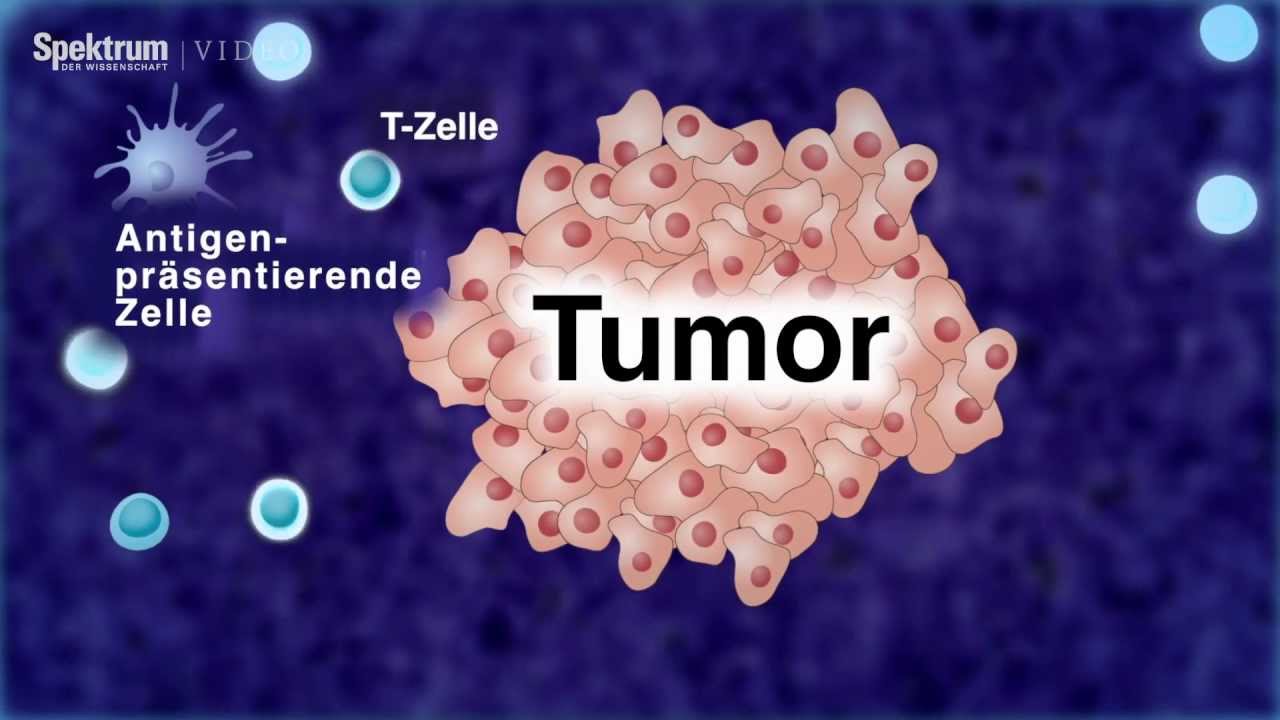 Mit Immunzellen gegen Krebs